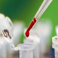 Срок хранения биохимического анализа крови